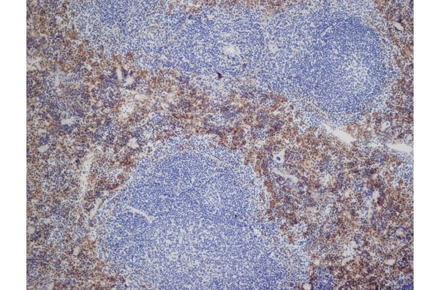 Immunohistochemistry - Anti-DECTIN 2 Antibody [D2.11E4] (A280209) - Antibodies.com