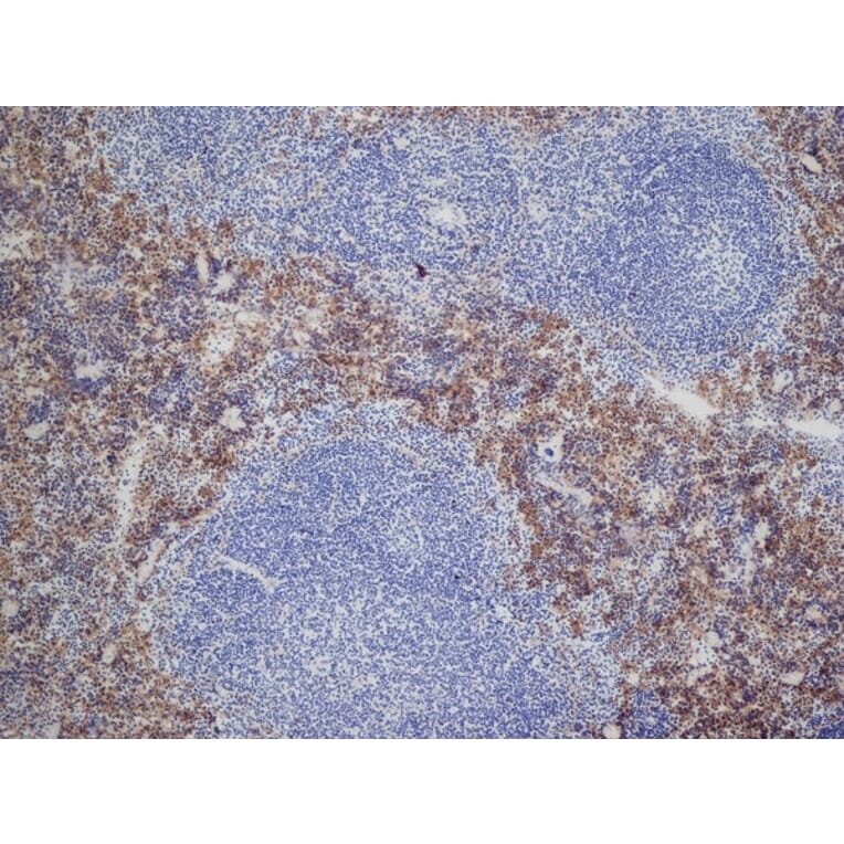 Immunohistochemistry - Anti-DECTIN 2 Antibody [D2.11E4] (A280209) - Antibodies.com