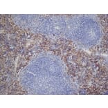 Immunohistochemistry - Anti-DECTIN 2 Antibody [D2.11E4] (A280209) - Antibodies.com