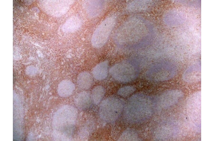 Immunohistochemistry - Anti-CD43 Antibody [DFT-1] (A280250) - Antibodies.com