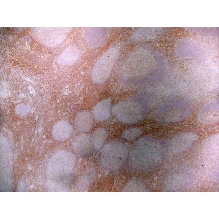 Immunohistochemistry - Anti-CD43 Antibody [DFT-1] (A280250) - Antibodies.com
