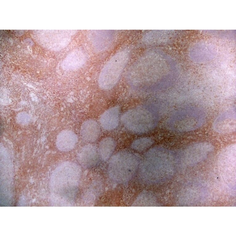 Immunohistochemistry - Anti-CD43 Antibody [DFT-1] (A280250) - Antibodies.com