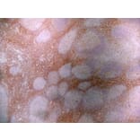 Immunohistochemistry - Anti-CD43 Antibody [DFT-1] (A280250) - Antibodies.com