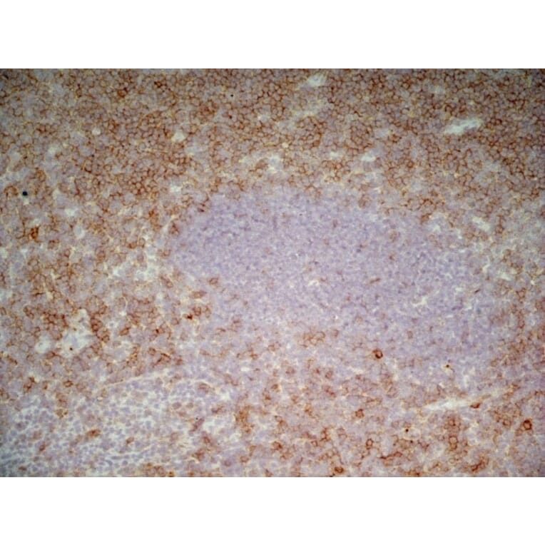 Immunohistochemistry - Anti-CD43 Antibody [DFT-1] (A280250) - Antibodies.com