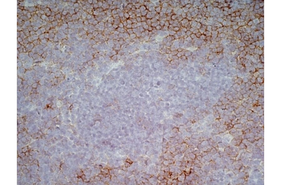 Immunohistochemistry - Anti-CD43 Antibody [DFT-1] (A280250) - Antibodies.com