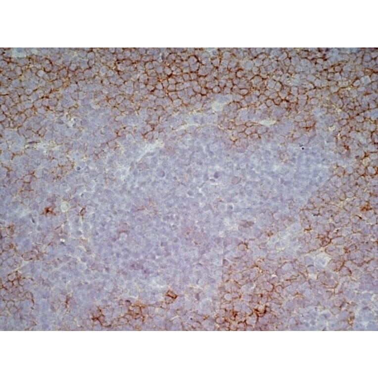 Immunohistochemistry - Anti-CD43 Antibody [DFT-1] (A280250) - Antibodies.com
