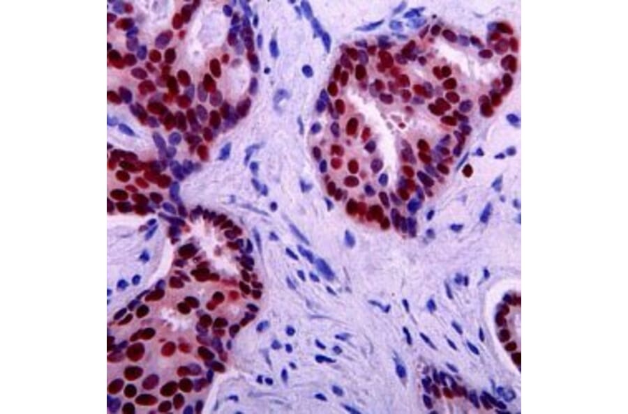 Immunohistochemistry - Anti-p53 Antibody [DO-7] (A280266) - Antibodies.com