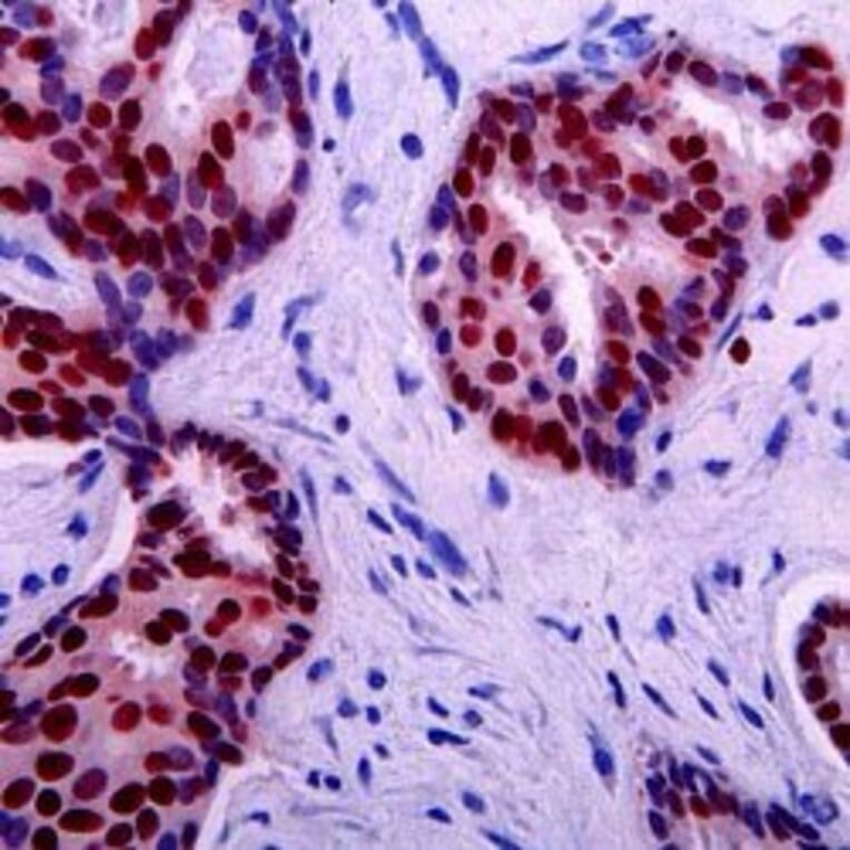 Immunohistochemistry - Anti-p53 Antibody [DO-7] (A280266) - Antibodies.com