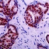Immunohistochemistry - Anti-p53 Antibody [DO-7] (A280266) - Antibodies.com