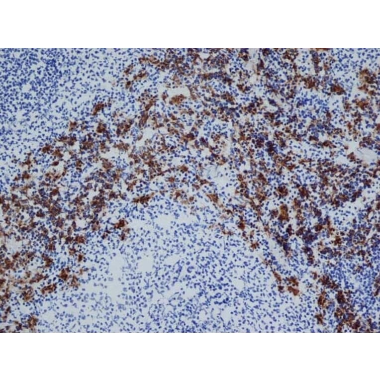 Immunohistochemistry - Anti-CD163 Antibody [ED2] (A280328) - Antibodies.com