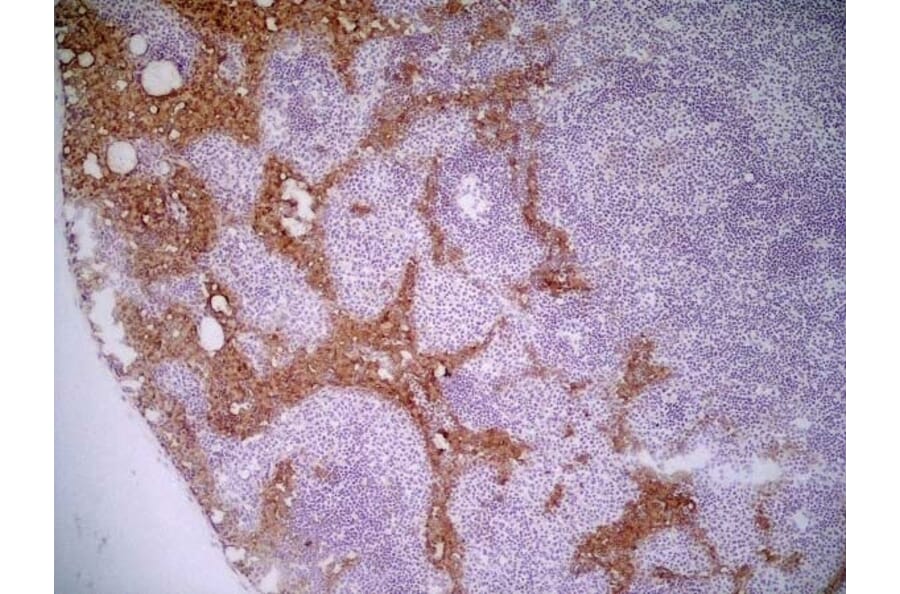 Immunohistochemistry - Anti-MARCO Antibody [ED31] (A280332) - Antibodies.com