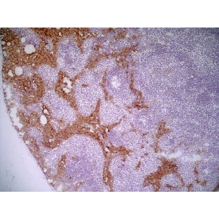 Immunohistochemistry - Anti-MARCO Antibody [ED31] (A280332) - Antibodies.com