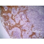 Immunohistochemistry - Anti-MARCO Antibody [ED31] (A280332) - Antibodies.com