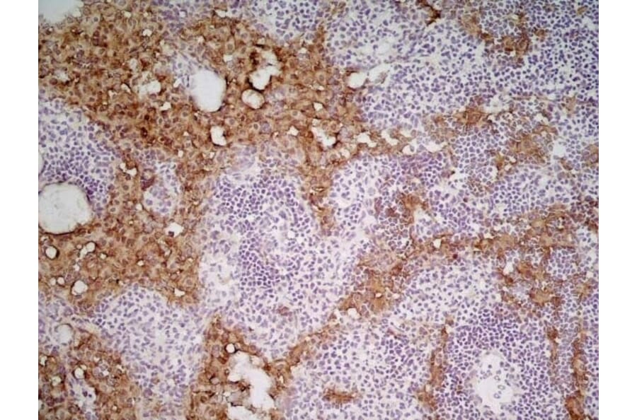 Immunohistochemistry - Anti-MARCO Antibody [ED31] (A280332) - Antibodies.com