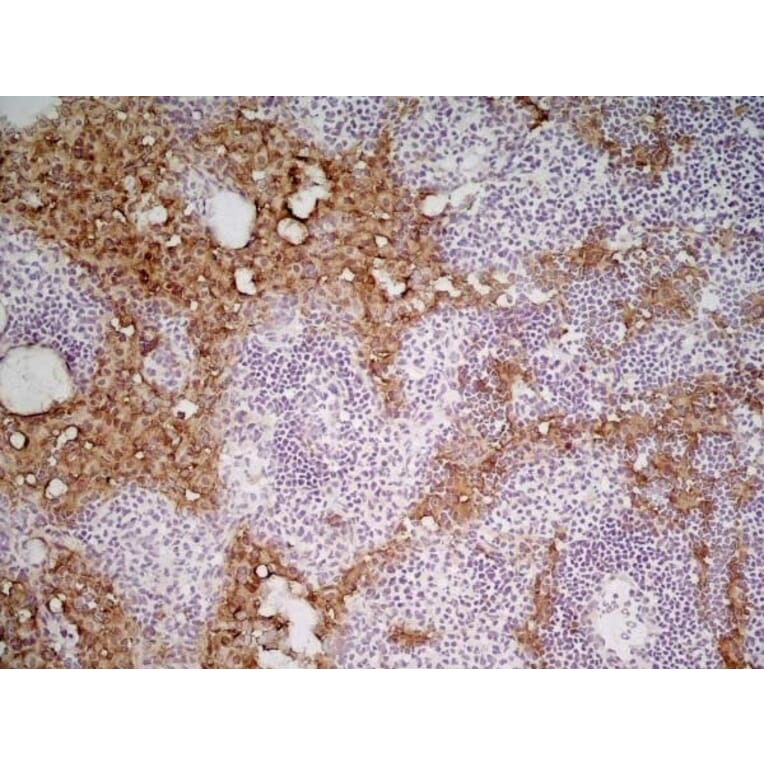 Immunohistochemistry - Anti-MARCO Antibody [ED31] (A280332) - Antibodies.com