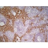 Immunohistochemistry - Anti-MARCO Antibody [ED31] (A280332) - Antibodies.com