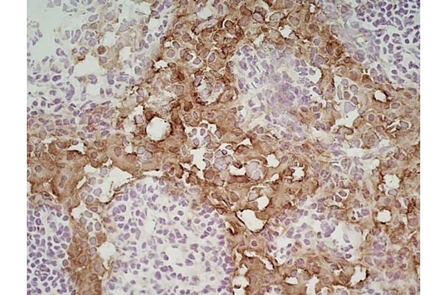 Immunohistochemistry - Anti-MARCO Antibody [ED31] (A280332) - Antibodies.com