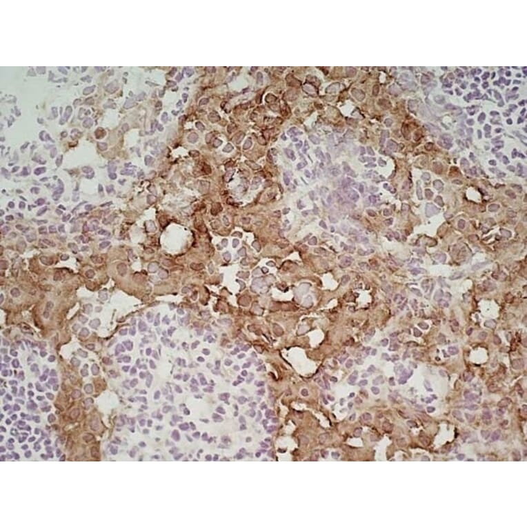 Immunohistochemistry - Anti-MARCO Antibody [ED31] (A280332) - Antibodies.com