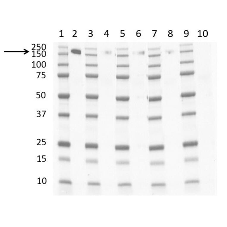 Western Blot - Anti-CD163 Antibody [EDHu-1] (A280344) - Antibodies.com