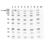 Western Blot - Anti-CD163 Antibody [EDHu-1] (A280344) - Antibodies.com