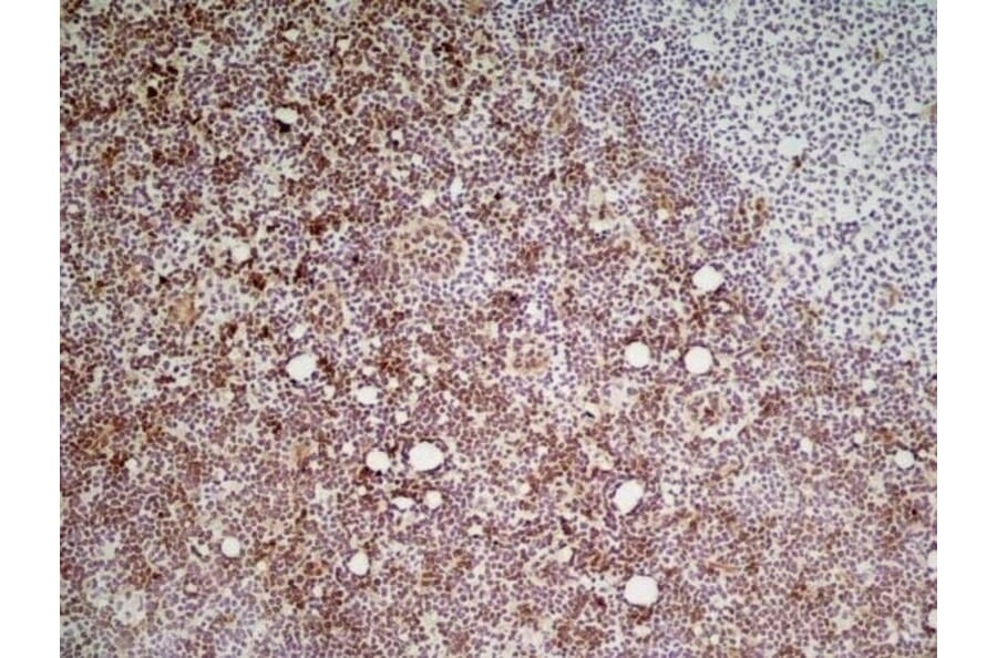 Immunohistochemistry - Anti-Ly6c Antibody [ER-MP20] (A280372) - Antibodies.com