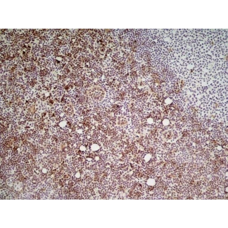 Immunohistochemistry - Anti-Ly6c Antibody [ER-MP20] (A280372) - Antibodies.com