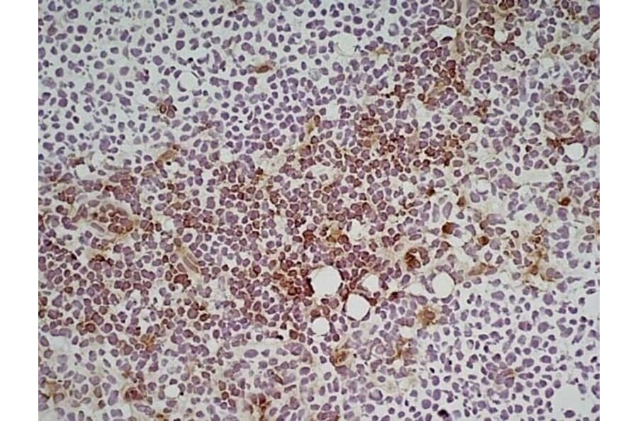 Immunohistochemistry - Anti-Ly6c Antibody [ER-MP20] (A280372) - Antibodies.com