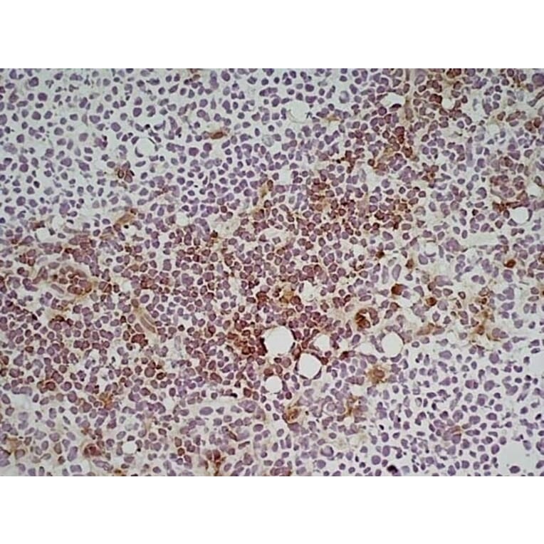Immunohistochemistry - Anti-Ly6c Antibody [ER-MP20] (A280372) - Antibodies.com