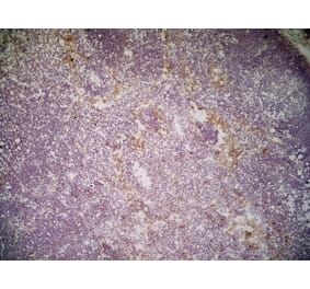 Immunohistochemistry - Anti-CLEC10A Antibody [ER-MP23] (A280375) - Antibodies.com