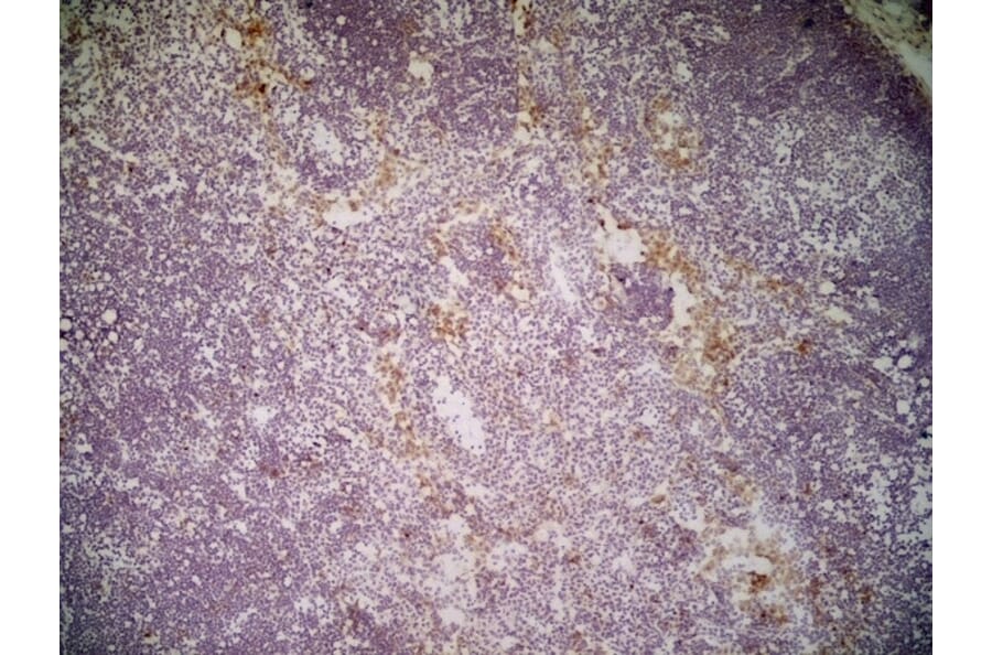 Immunohistochemistry - Anti-CLEC10A Antibody [ER-MP23] (A280375) - Antibodies.com