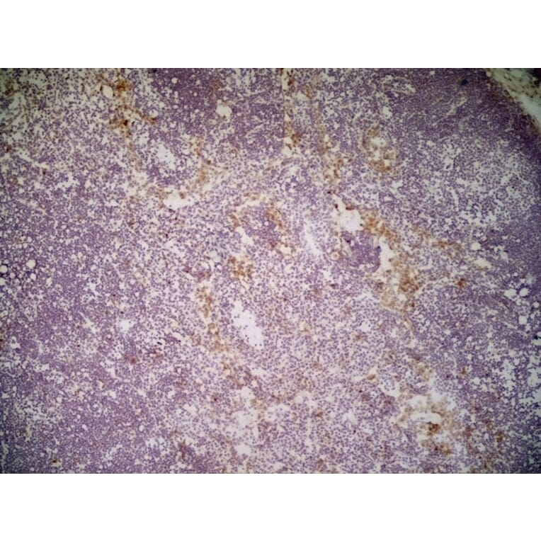 Immunohistochemistry - Anti-CLEC10A Antibody [ER-MP23] (A280375) - Antibodies.com