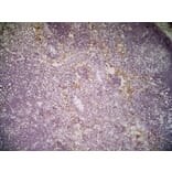 Immunohistochemistry - Anti-CLEC10A Antibody [ER-MP23] (A280375) - Antibodies.com
