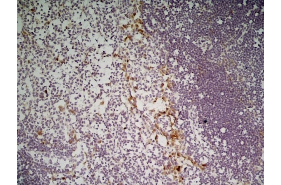 Immunohistochemistry - Anti-CLEC10A Antibody [ER-MP23] (A280375) - Antibodies.com