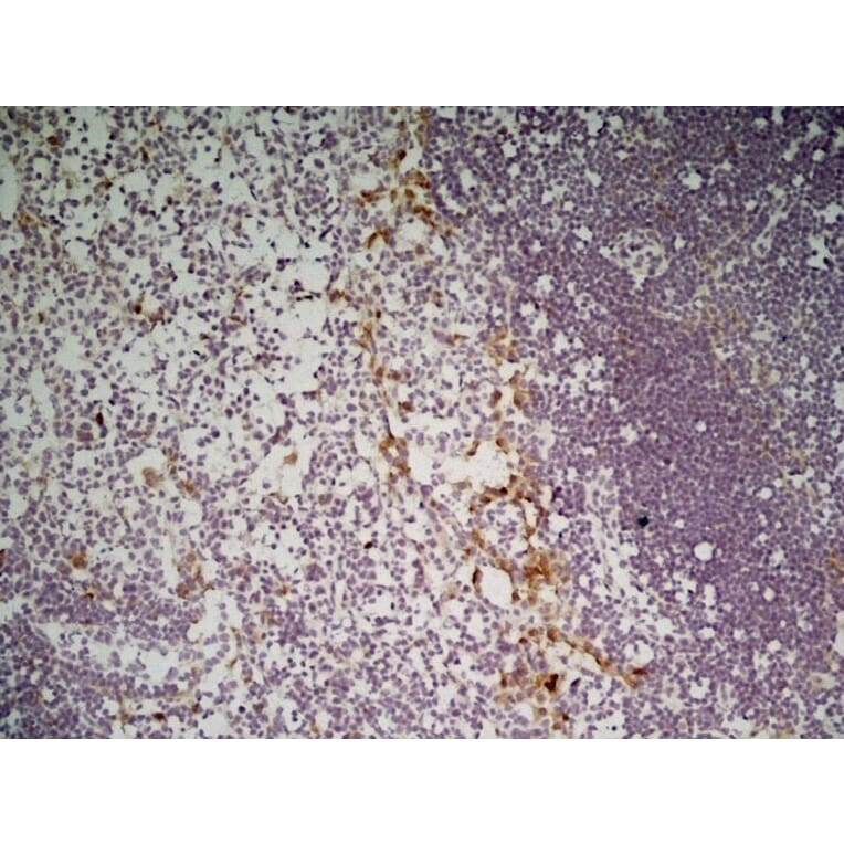 Immunohistochemistry - Anti-CLEC10A Antibody [ER-MP23] (A280375) - Antibodies.com