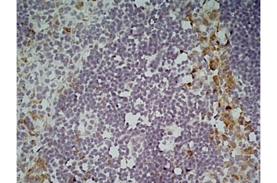 Immunohistochemistry - Anti-CLEC10A Antibody [ER-MP23] (A280375) - Antibodies.com