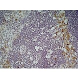 Immunohistochemistry - Anti-CLEC10A Antibody [ER-MP23] (A280375) - Antibodies.com