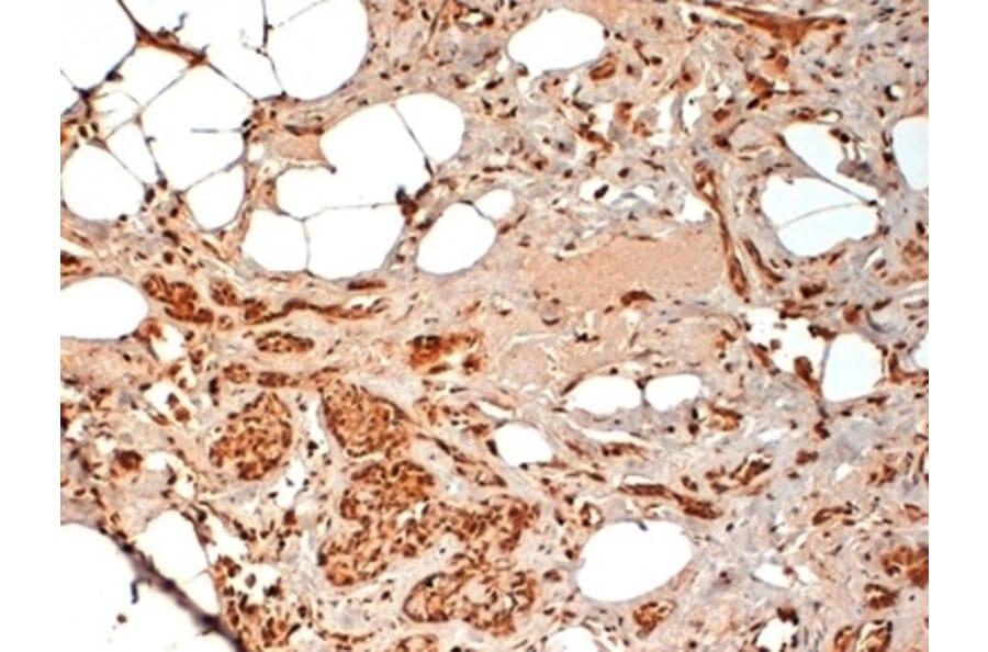 Immunohistochemistry - Anti-CD44 Antibody [F10-44-2] (A280397) - Antibodies.com