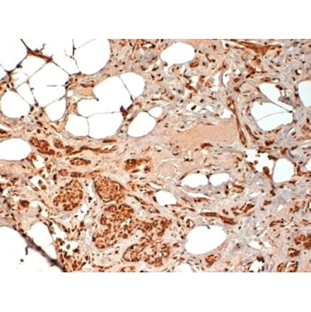 Immunohistochemistry - Anti-CD44 Antibody [F10-44-2] (A280397) - Antibodies.com