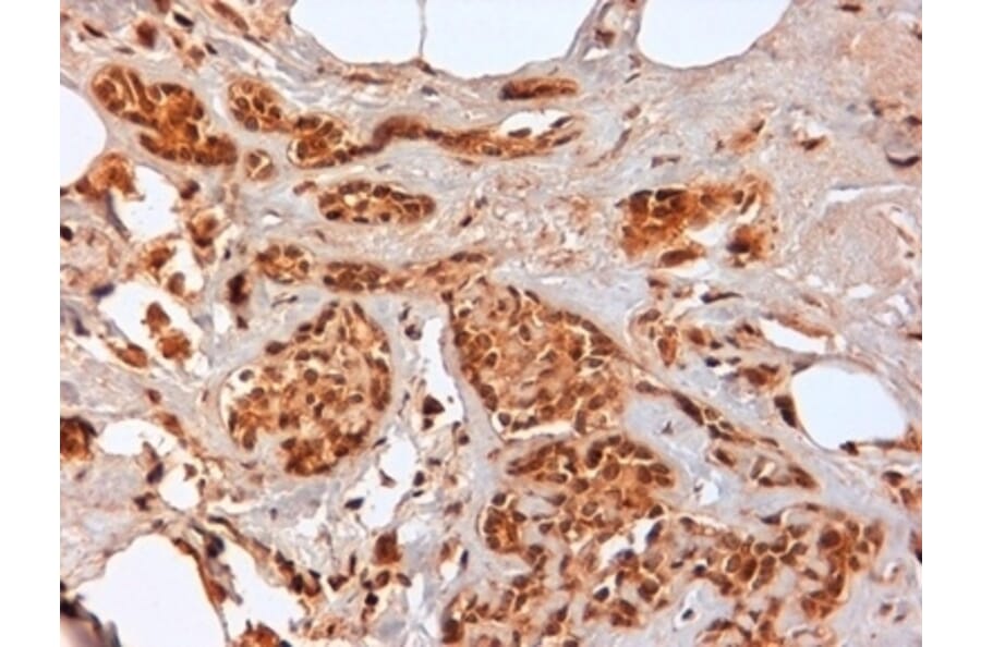 Immunohistochemistry - Anti-CD44 Antibody [F10-44-2] (A280397) - Antibodies.com