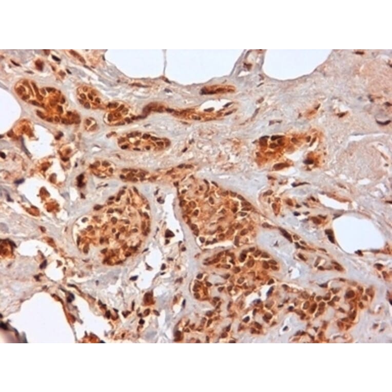 Immunohistochemistry - Anti-CD44 Antibody [F10-44-2] (A280397) - Antibodies.com