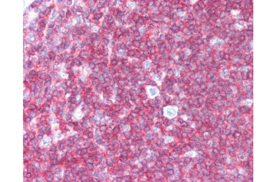 Immunohistochemistry - Anti-CD45 Antibody [F10-89-4] (A280409) - Antibodies.com