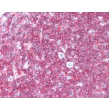 Immunohistochemistry - Anti-CD45 Antibody [F10-89-4] (A280409) - Antibodies.com