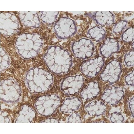 Immunohistochemistry - Anti-CD45 Antibody [F10-89-4] (A280409) - Antibodies.com