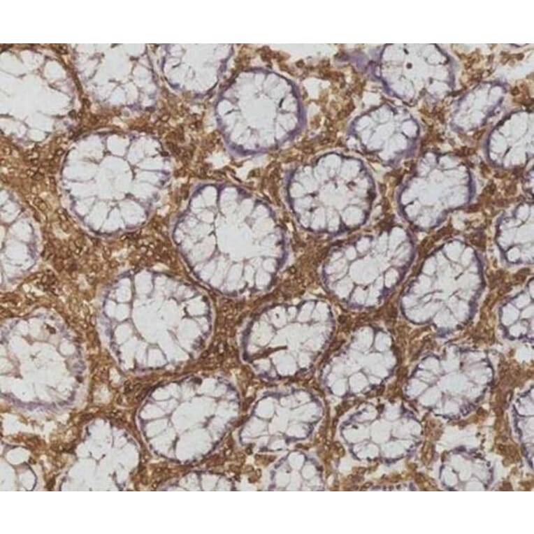 Immunohistochemistry - Anti-CD45 Antibody [F10-89-4] (A280409) - Antibodies.com