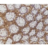 Immunohistochemistry - Anti-CD45 Antibody [F10-89-4] (A280409) - Antibodies.com