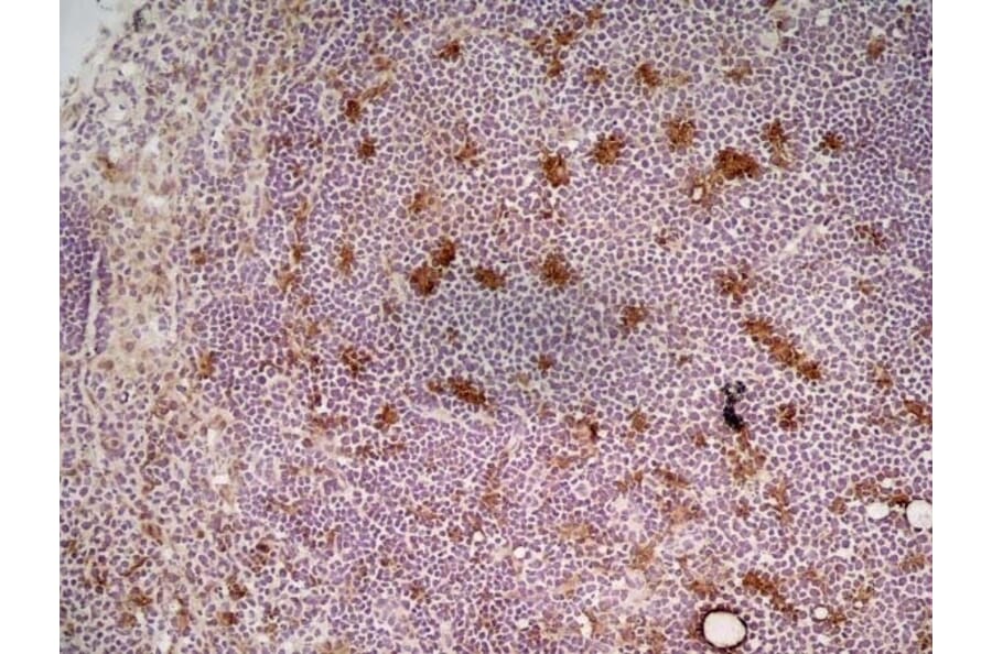 Immunohistochemistry - Anti-CD68 Antibody [FA-11] (A280454) - Antibodies.com