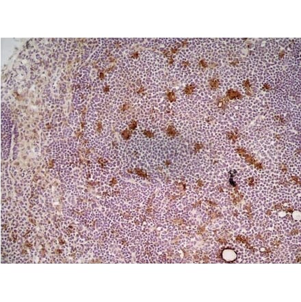 Immunohistochemistry - Anti-CD68 Antibody [FA-11] (A280454) - Antibodies.com
