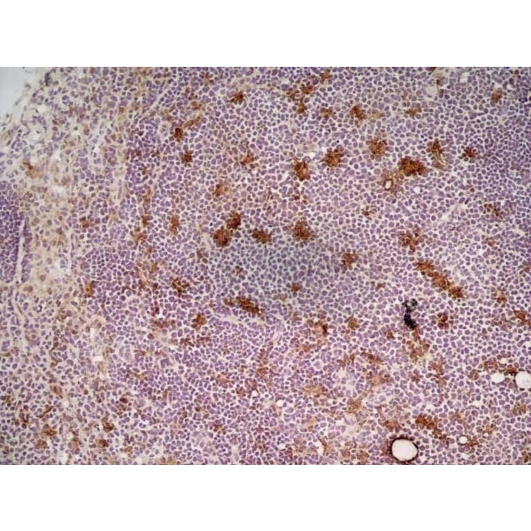 Immunohistochemistry - Anti-CD68 Antibody [FA-11] (A280454) - Antibodies.com