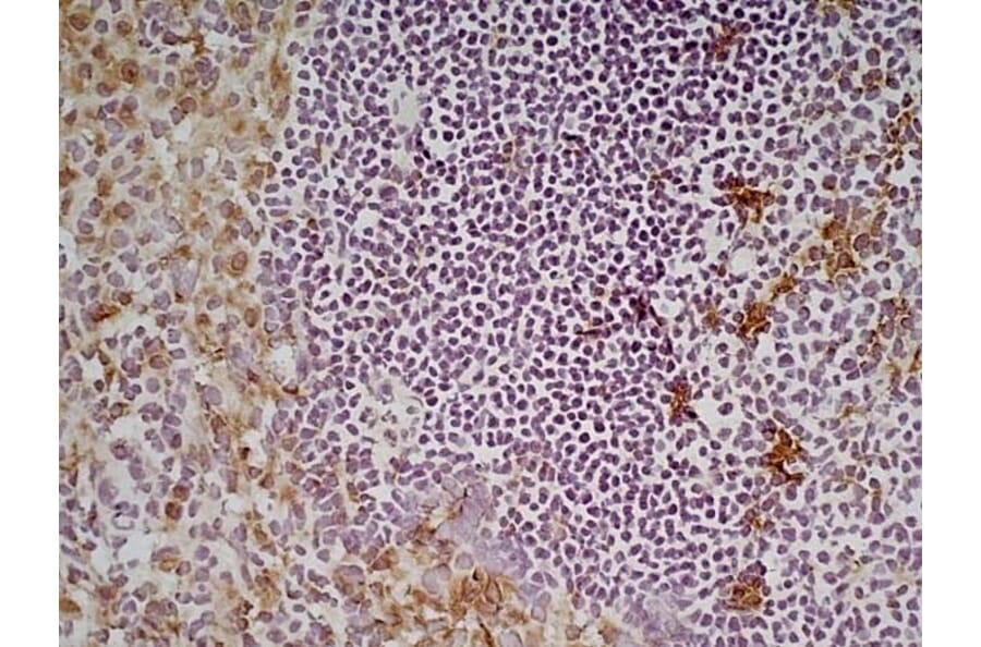 Immunohistochemistry - Anti-CD68 Antibody [FA-11] (A280454) - Antibodies.com