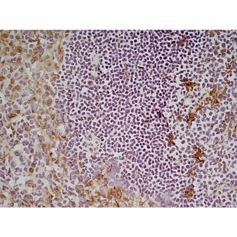Immunohistochemistry - Anti-CD68 Antibody [FA-11] (A280454) - Antibodies.com
